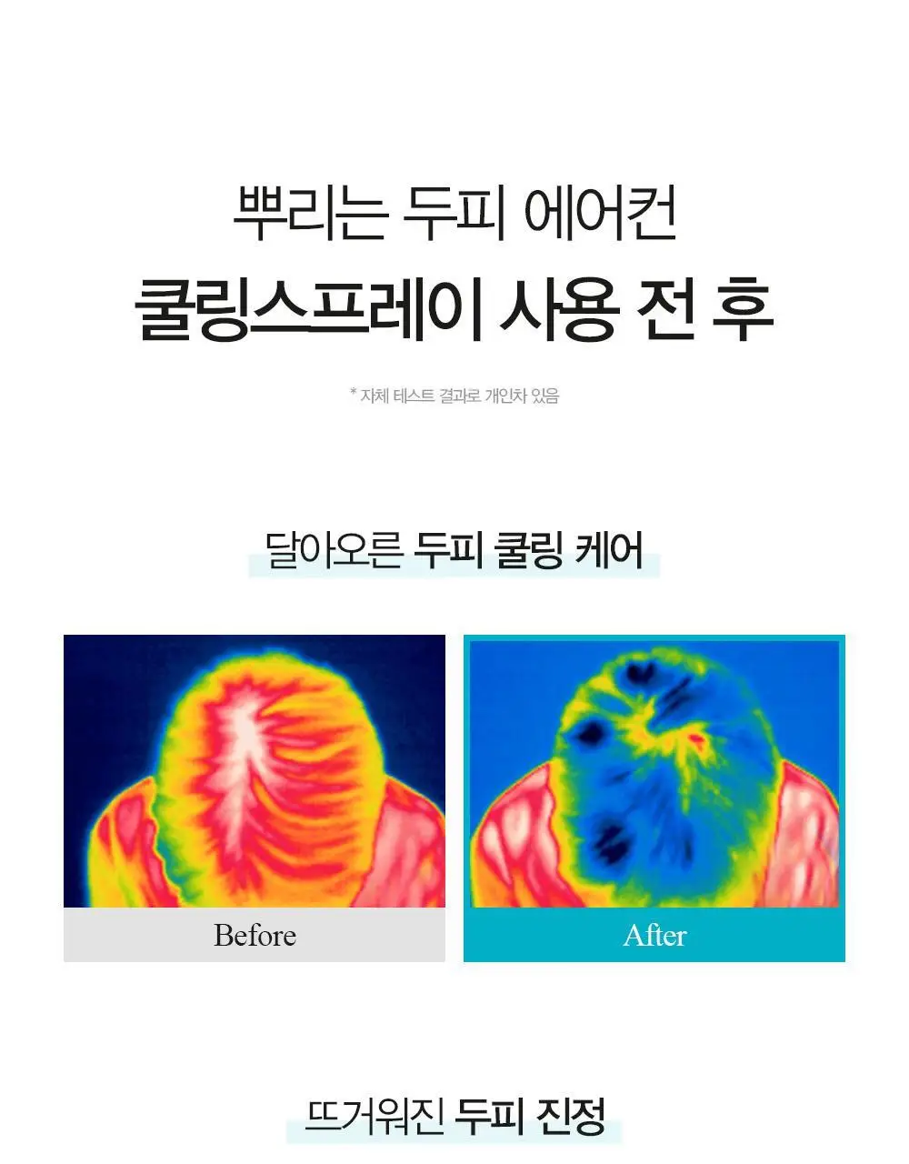 [탈모증상완화/두피열케어] 달리프 쿨링스프레이 더블기획 100ml+100ml 상세페이지 18